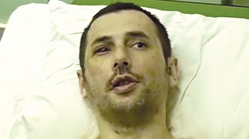 Zverski mučen: Petrović u bolnici