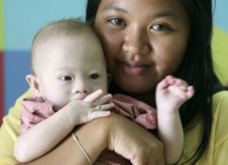 Surogat majka prihvatila je dete sa Daunovim sindromom nakon što su ga roditelji odbacili