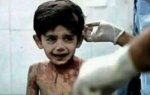 Sirijski dečakl