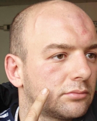 Završio u bolnici: Nenad Đurić