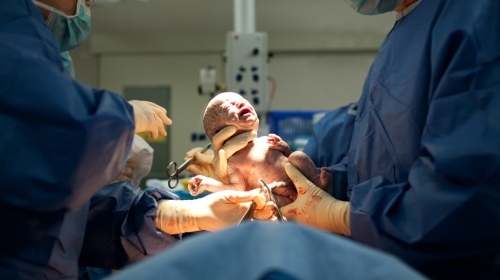 porođaj trudnica beba bolnica