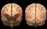 Ljudski mozak | Foto: Profimedia