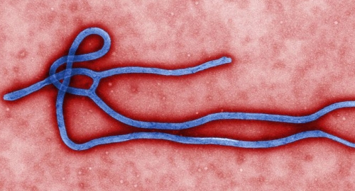 Virus ebole, jedne od najmučnijih boljki ikada