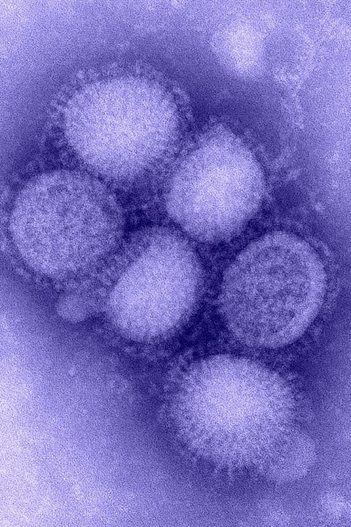 H1N1 Virus