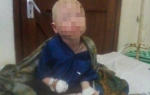 Albino dečaku odsekli ruku da naprave napitak