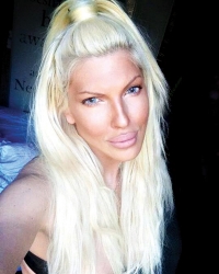 Možda se opekla na vruće mleko