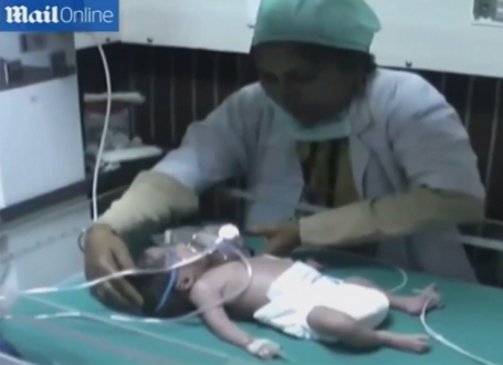 Beba sa dve glave / Printskrin:YouTube/ USWorldNews