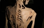 Skelet obolelog od FOP-a