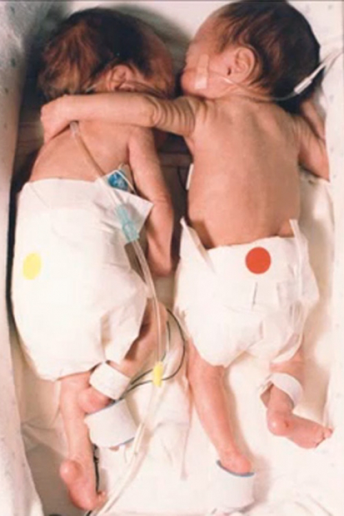 Bebe blizanci