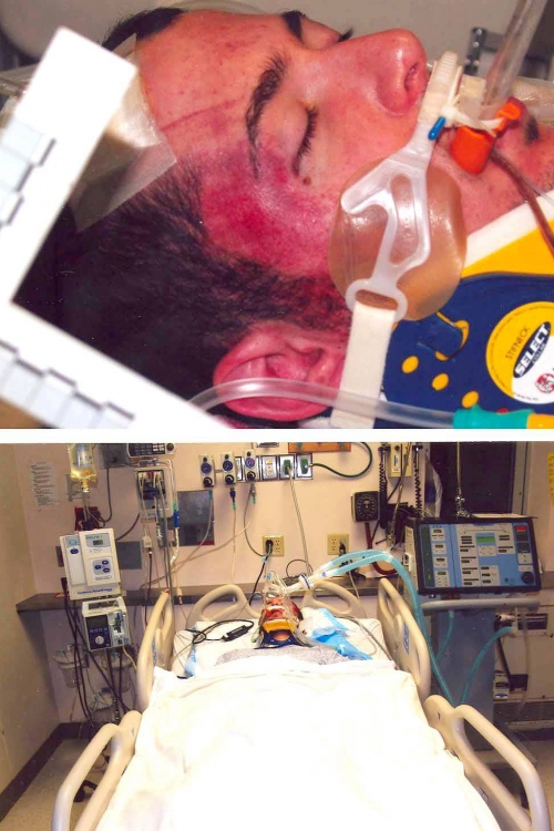 Brajan Štajnhauer u bolnici nakon povreda u tuči