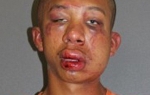 Rejmond Folneder, na policijskoj fotografiji snimljenoj nakon što ga je razbesneli otac propustio kroz šake