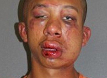 Rejmond Folneder, na policijskoj fotografiji snimljenoj nakon što ga je razbesneli otac propustio kroz šake