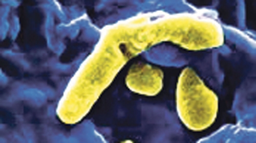 Zloglasna  bakterija  Pseudomonas  aeruginosa
