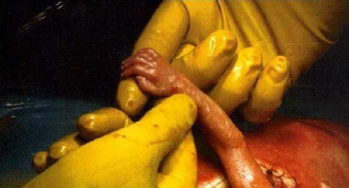 Bebica posegnula za prstom svog spasitelja