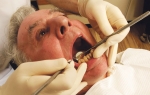 U vilici svakog  četvrtog odraslog  stanovnika Srbije  nedostaje više od  10 zuba