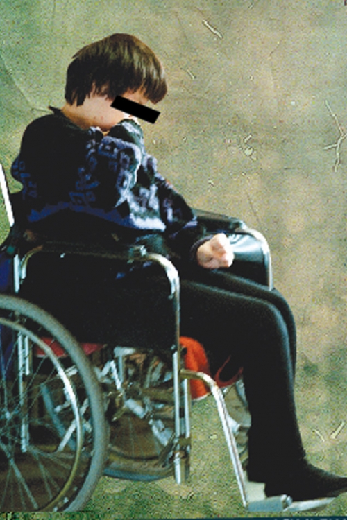 Dečak I. U. (10) ima  cerebralnu paralizu  i u školu je upisan  tek kada su  roditelji  zapretili  tužbom
