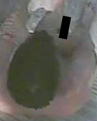 Žarko